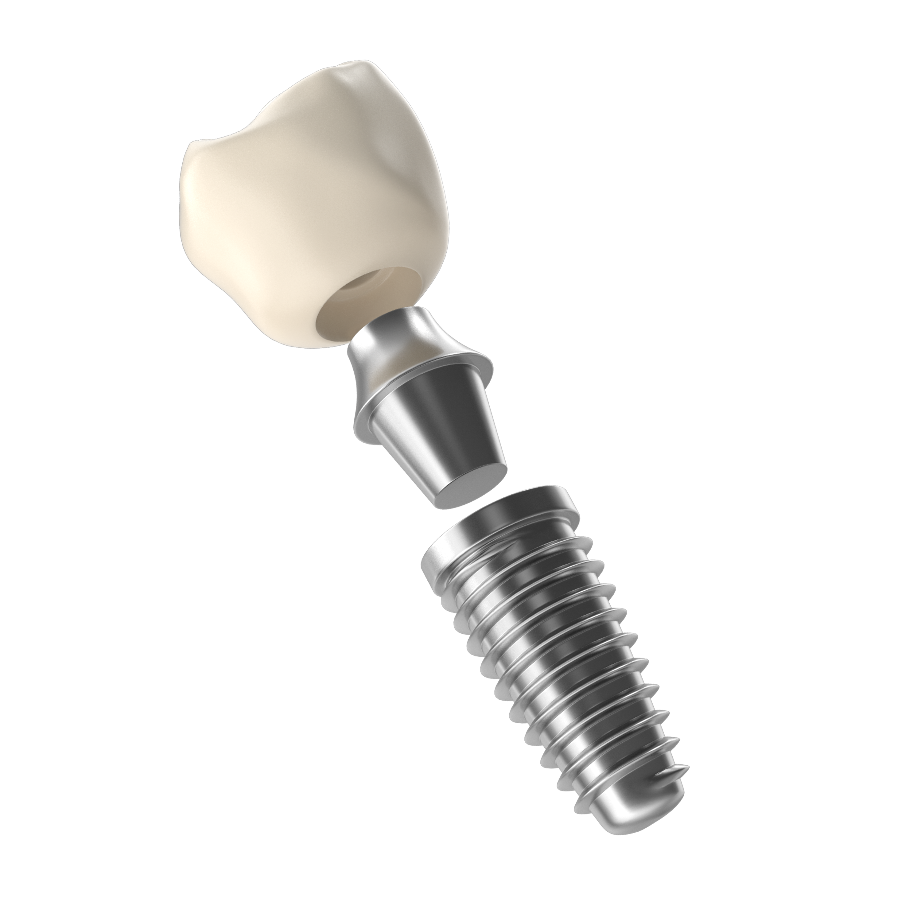 3D-Modell eines Zahnimplantats mit Krone, Abutment und Schraube